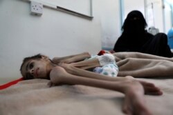 FILE - Faid Samim, 7, a malnourished boy who also has cerebral palsy, lies on a bed at the malnutrition treatment ward of al-Sabeen hospital in Sana'a, Yemen, Dec. 28, 2020.