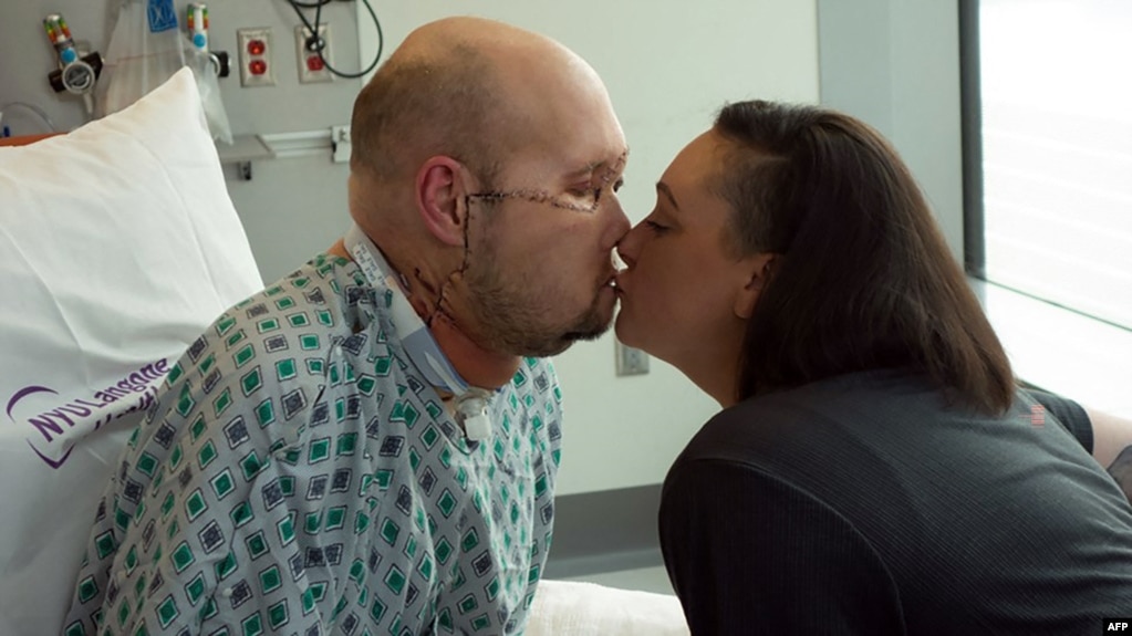 在纽约大学朗格尼健康中心发布的这张未注明日期的照片中，亚伦·詹姆斯在纽约朗格尼健康中心接受第一次全眼和部分面部移植手术后康复期间亲吻他的妻子梅根。 (法新社照片)(photo:VOA)