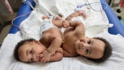 Bayi kembar siam, Amari dan Javar Ruffin, di Rumah Sakit Anak Philadelphia, 20 Maret 2024. Keduanya berhasil dipisahkan dalam operasi 21 Agustus, dan diperbolehkan pulang ke rumah 8 Oktober 2024. 