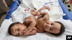 Bayi kembar siam, Amari dan Javar Ruffin, di Rumah Sakit Anak Philadelphia, 20 Maret 2024. Keduanya berhasil dipisahkan dalam operasi 21 Agustus, dan diperbolehkan pulang ke rumah 8 Oktober 2024. 