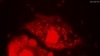 This video screen shot shows what happens when nanomachines drill through the cell membrane. The tiny motors drill through the nucleus and the entire cell disintegrates. (Photo courtesy Durham University UK)