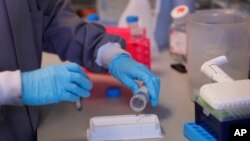 Jess O'Hara a research technician works on the process of testing antibodies to see if they bind to the virus, in the laboratory at Imperial College in London, July 30, 2020. 