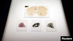 FILE - Microscopic slides of human brain are seen at the Multiple Sclerosis and Parkinson’s UK Tissue Bank at Imperial College London, Britain, June 3, 2016. 