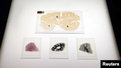 FILE - Microscopic slides of human brain are seen at the Multiple Sclerosis and Parkinson’s UK Tissue Bank at Imperial College London, Britain, June 3, 2016. 