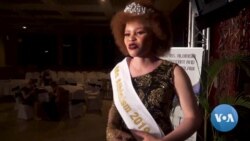 Malawi Pageant Shines Light on Albino Beauty