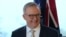 FILE - Australian Prime Minister Anthony Albanese smiles at the end of a press conference in Sydney, July 4, 2023. Albanese will visit China Nov. 4 through 7.