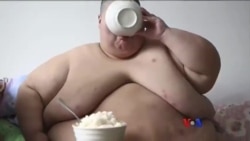 အဝလွန်မှုနဲ့ ကင်ဆာရောဂါ