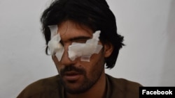 Abdul Baqi, 22, thought his family would help him get married. Instead, his father and four brothers accused him of violating Islamic values and removed his eyes to punish him.