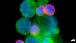 Circulating tumor cell cluster of a patient with metastatic prostate cancer