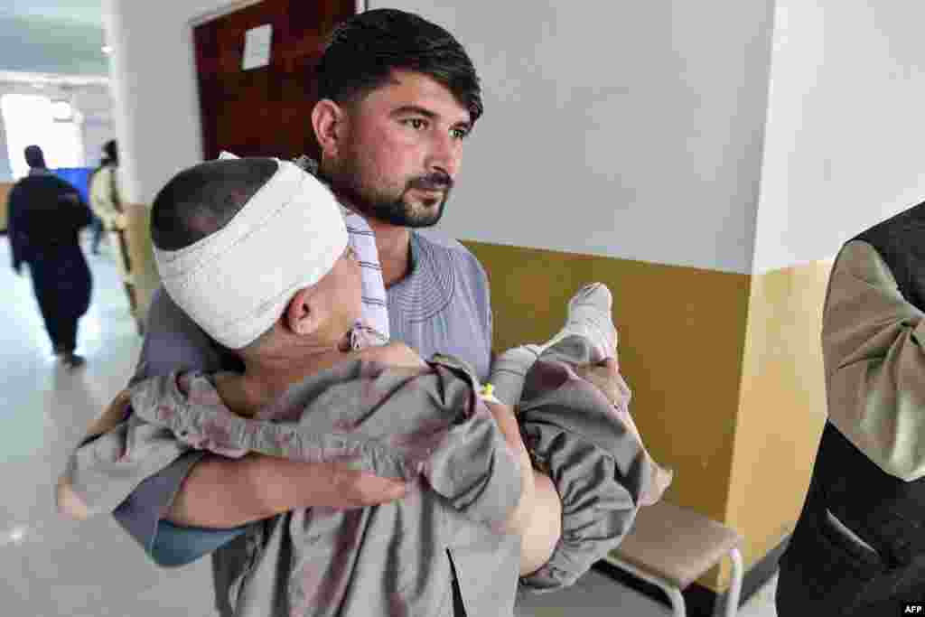 یو کس ژوبل شوی ماشوم د شبرغان یو روغتون ته راوړی. 