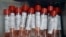 Vials used in the test to detect the presence of COVID-19 are seen at a testing site affiliated with the Methodist Health System, in Omaha, Neb., Friday, April 24, 2020.