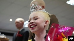 FILE - Ayanda Sibanda smiles, after she was crowned Miss Albinism Zimbabwe 2019 at an albino pageant held in Harare, early Saturday, May 25, 2019.