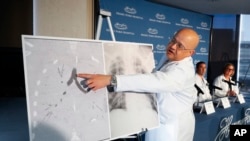 Dr. Hassan Nemeh, Surgical Director of Thoracic Organ Transplant, shows areas of a patient's lungs during a news conference at Henry Ford Hospital in Detroit, Nov. 12, 2019. 