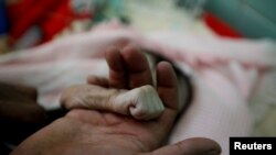 Saleh al-Faqeh holds the hand of his 4-month-old daughter, Hajar, who died at the malnutrition ward of al-Sabeen hospital in Sanaa, Yemen, Nov. 15, 2018.