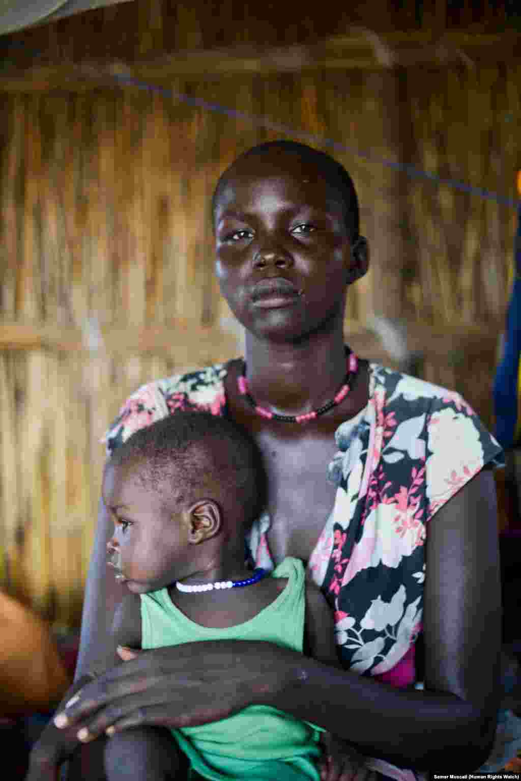 Nyacour sought shelter in the UNMISS camp in Bentiu when militia fighters allied to the South Sudanese army attacked her village in Koch county. She says she was beaten and her hut burnt down in the attack. Her husband is still hiding in the bush. 