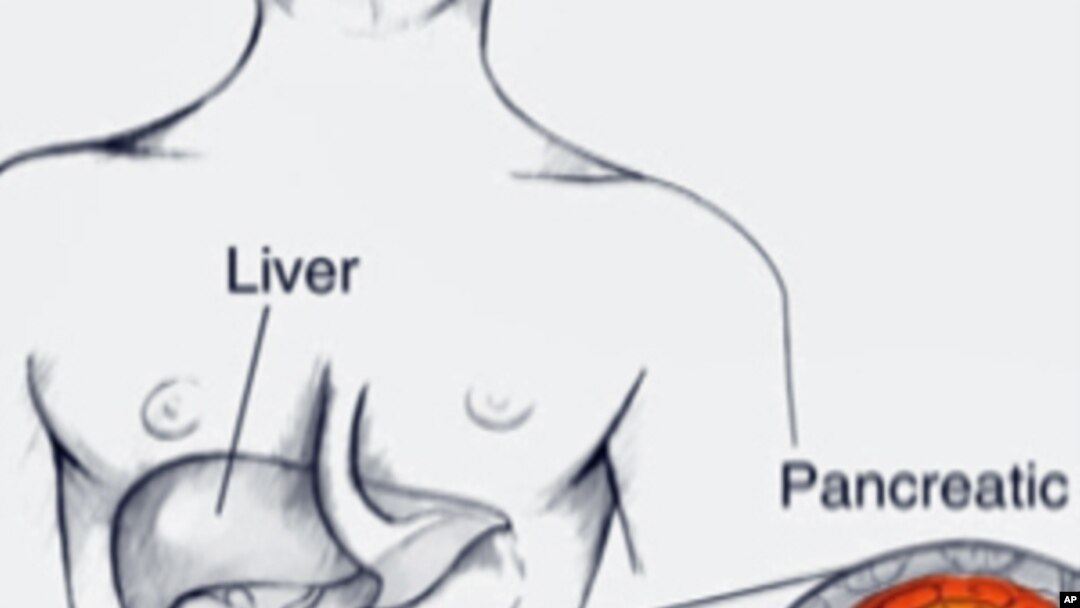 Scientists at Fred Hutchinson Cancer Research Center report they've found a way to break through the unique biological barrier a pancreas cancer tumor builds around itself in mice. 