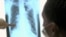 "Good" cholesterol may actually increase heart attack risks in some people, researchers said Thursday.