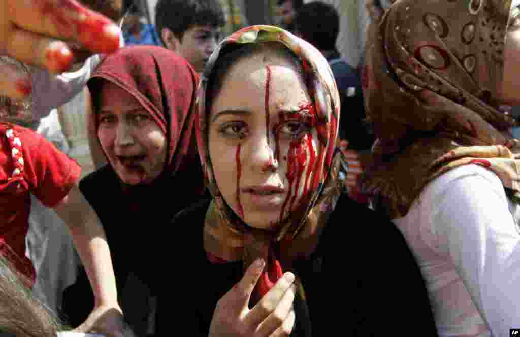 Injured Syrian women arrive at a field hospital after an air strike hit their homes in the town of Azaz on the outskirts of Aleppo, Syria, August 15, 2012.