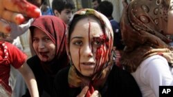 Injured Syrian women arrive at a field hospital after an air strike hit their homes in the town of Azaz on the outskirts of Aleppo, Syria, August 15, 2012.