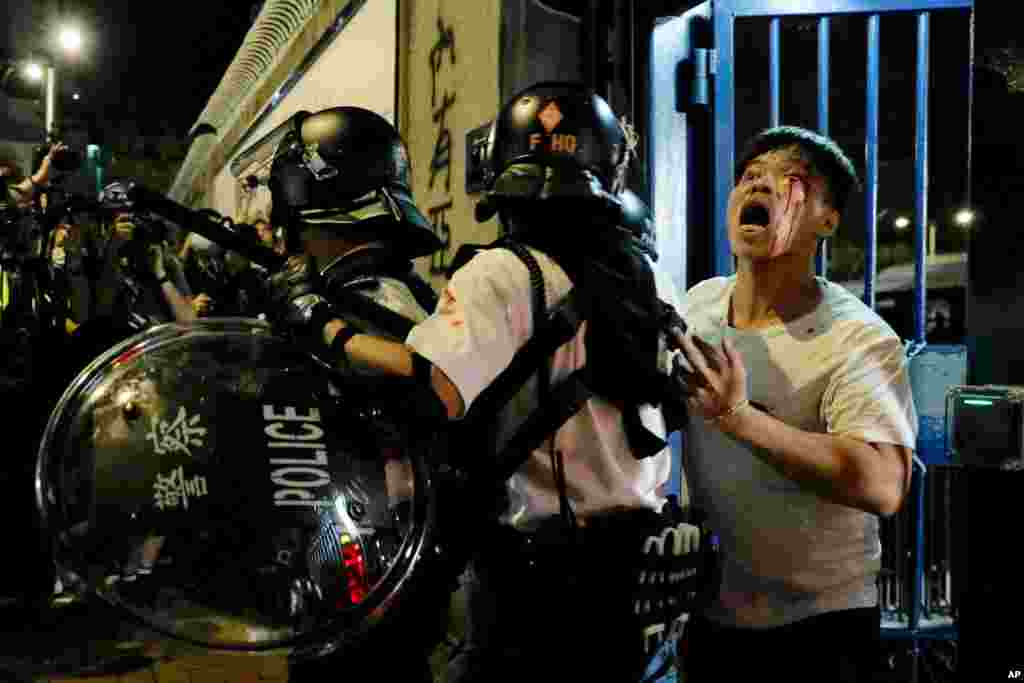 An injured man is taken away by policemen after he was attacked by protesters outside the Kwai Chung police station in Hong Kong.