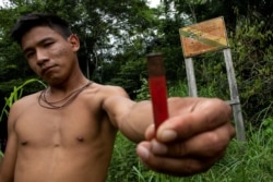 FILE - An indigenous man of the Uru-eu-wau-wau tribe shows the casing of a shell that had been fired into a sign, which warns of the limits of the tribe's reservation, near Campo Novo de Rondonia, Brazil, Jan. 31, 2019.