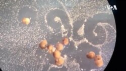 Xenobots - Moskalkov USAGM