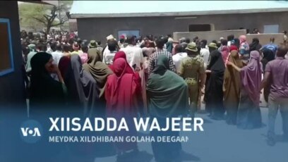 Vaginalar turlari va ular uchun soch turmagi