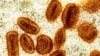 Officials: Pakistan mpox strain is different from DRC strain