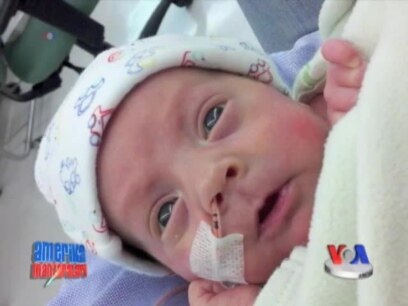 Erta tug'ilganlar salomatligi - Premature babies