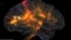 An image of activity in a human brain