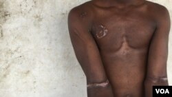 Foto de arquivo de uma vitima de brutalidade policial