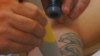 Tattoo Removal Gains Popularity