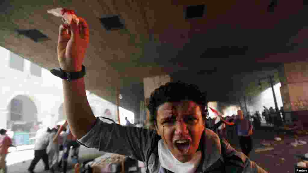 A member of the Muslim Brotherhood and supporter of ousted Egyptian President Mohamed Morsi shouts slogans after he is injured in front Azbkya police station during clashes at Ramses Square, Cairo, August 16, 2013. 