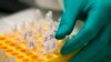 A researcher prepares DNA in a laboratory at the Bioaster Technology Research Institute in Lyon