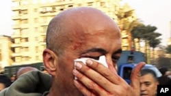 AP photographer Nasser Gamil Nasser after being beaten by a policeman and injured while shooting protests in Cairo, January 25, 2011