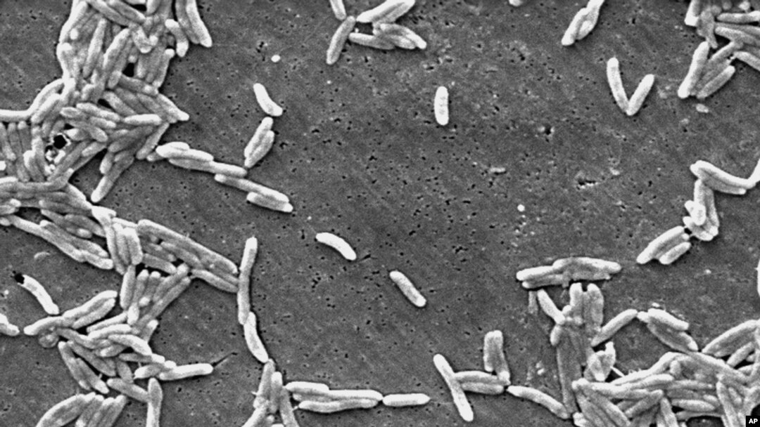 Esta imagen de microscopio electrónico de 2004, disponible en los Centros para el Control y la Prevención de Enfermedades, muestra la bacteria Gram-Campylobacter. (Janice Haney Carr/CDC via AP).