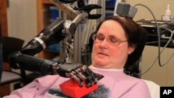 Mind-Controlled Artificial Hand