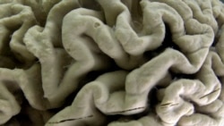 Quiz - Study: How the Brain Cleans Itself