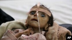 FILE - In this Tuesday, March 22, 2016 photo, infant Udai Faisal, who is suffering from acute malnutrition, is hospitalized at Al-Sabeen Hospital in Sanaa, Yemen.