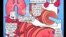 美国专讯:1)警惕全球儿童糖尿病患者增加 2)美国医生使用漫画减少小患者对医药的恐惧