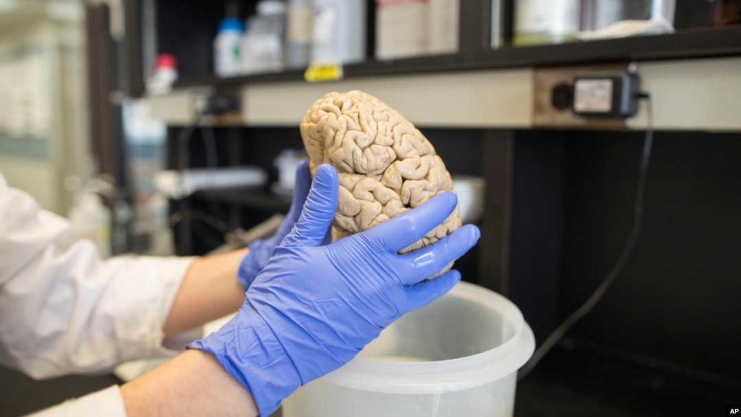 Seorang ilmuwan memegang otak manusia di sebuah laboratorium di Northwestern University, Chicago. (Foto: Dok)