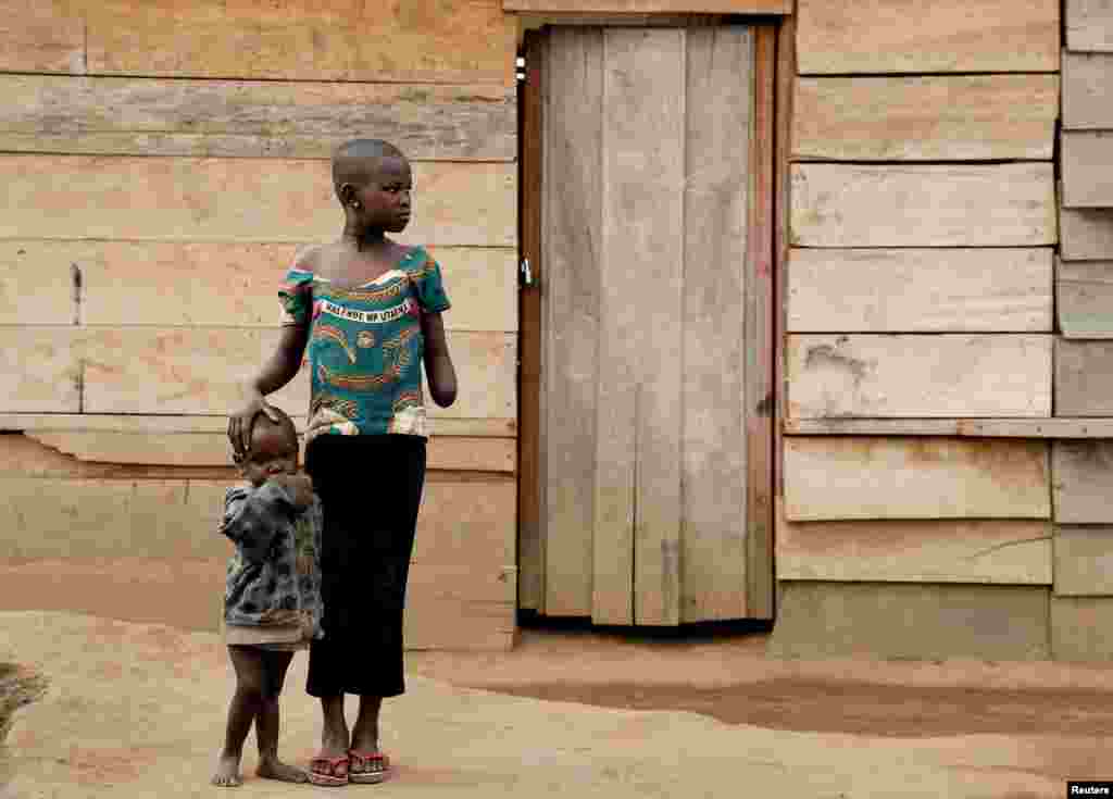 Mave Grace, 11, who had part of her arm chopped off by militiamen when they attacked the village of Tchee, stands with her sister Racahele-Ngabausi, 2, in an Internally Displaced Camp in Bunia, Ituri province, eastern Democratic Republic of Congo, April 12, 2018. According to witnesses, militiamen killed her pregnant mother, her three brothers and injured her sister, Racahele-Ngabausi.