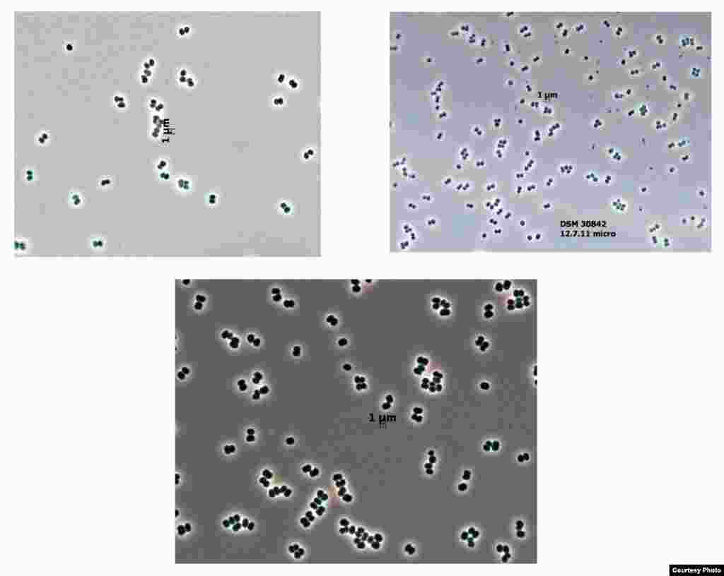 FoClean Room Microbes &ndash; &lsquo;จุลินทรีย์ห้องสะอาด&rsquo; อาศัยอยู่ในห้องปลอดเชื้อขององค์การนาซ่าที่รัฐฟลอริด้า ซึ่งเป็นห้องที่สร้างขึ้นเพื่อป้องกันเชื้อโรคและจุลินทรีย์ต่างๆ ไม่ให้ติดไปกับยานอวกาศที่ไปลงจอดบนดาวดวงอื่น แต่นักวิทยาศาสตร์พบจุลินทรีย์ชนิดนี้ในห้องปลอดเชื้อดังกล่าว และยังพบด้วยว่าจุลินทรีย์นี้มีความทนทานต่อความแห้งแล้ง สภาพความเป็นกรด สภาพอากาศรุนแรง และรังสี UV ทำให้เกิดความกังวลว่าจุลินทรีย์ชนิดนี้อาจติดไปกับยานอวกาศที่ไปลงจอดดาวดวงอื่นได้&nbsp;