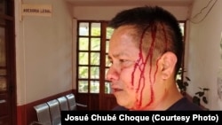 Bolivian journalist Josue Chube Choque received multiple hits to his body and face after being ambushed while covering confrontations between police and protesters in the town of Mairana, Bolivia, on Oct. 29, 2024.