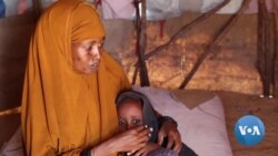 Severe Drought Puts 2 Million Somalis at Risk of Starvation