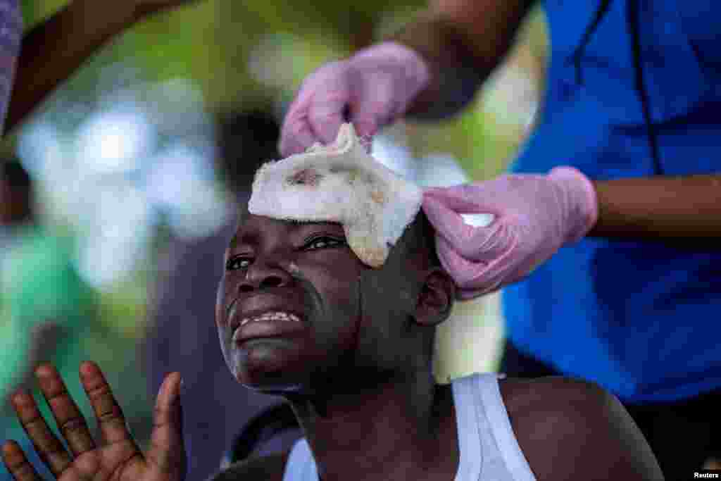 A boy injured after Saturday's 7.2 magnitude quake cries while being treated at the Ofatma Hospital, in Les Cayes, Haiti, Aug. 18, 2021.