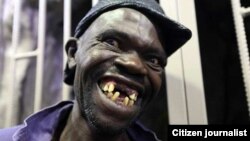 Othole isicoco sikaMr. Ugly 2015 uMnumzana Mison Sere