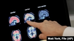 FILE - A doctor looks at PET brain scans at Banner Alzheimers Institute in Phoenix on Aug. 14, 2018. 