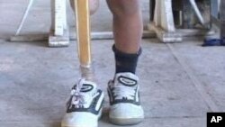 آمار دقیقی از تعداد افراد معلول در بامیان تاهنوز وجود ندارد