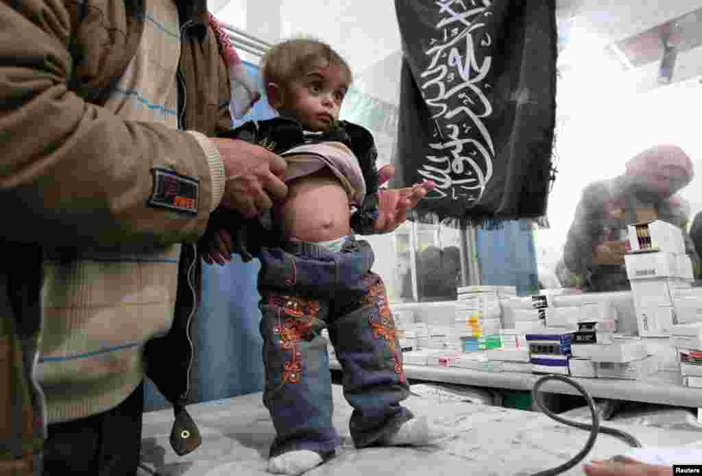 A man brings a malnourished boy to a doctor at a field hospital in Aleppo, January 24, 2013.  